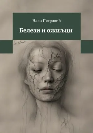 Белези и ожиљци